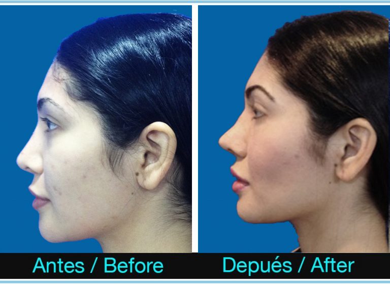 101_bichetomia-768x561