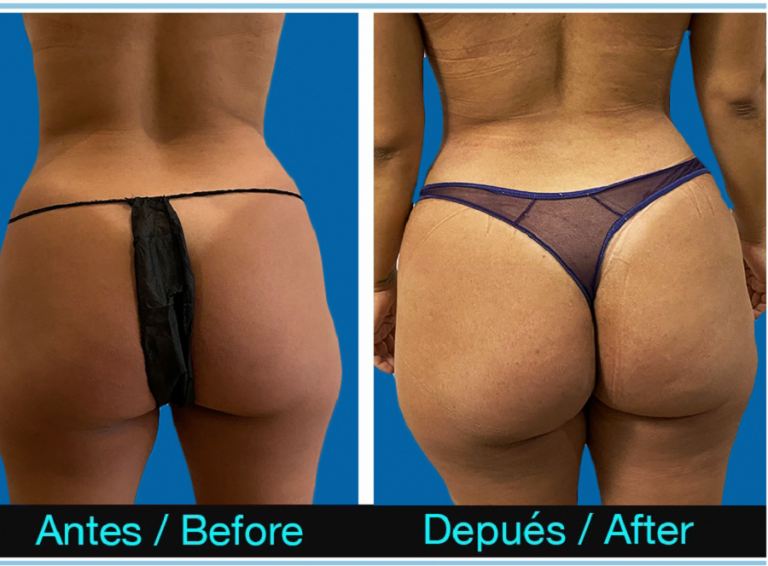 1_MummyMakeOver-768x566