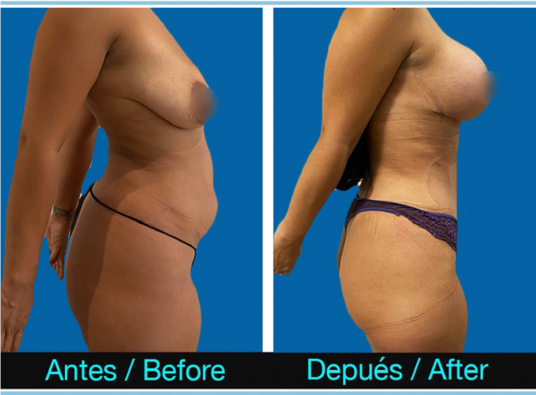 2_MummyMakeOver-768x566