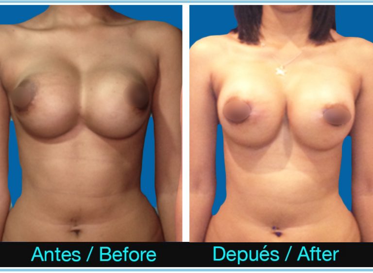 38_cura-de-sinmastia-768x561 (1)