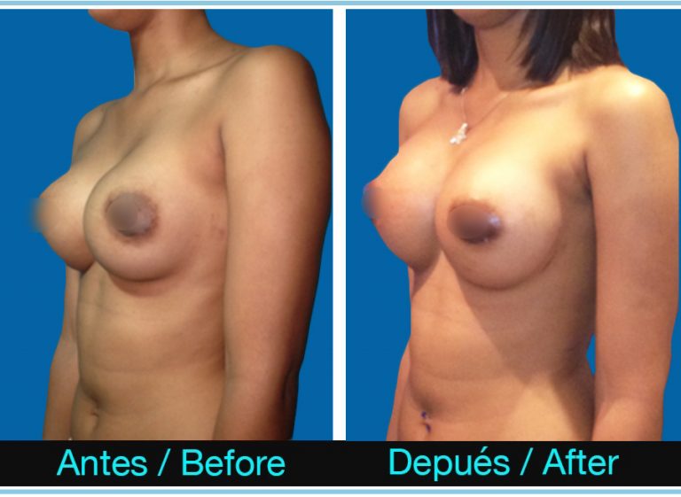 39_cura-de-sinmastia-768x561 (1)