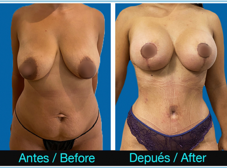 3_MummyMakeOver-768x566