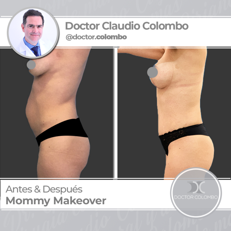 AD-COLOMBO-MMO32-1-768x768