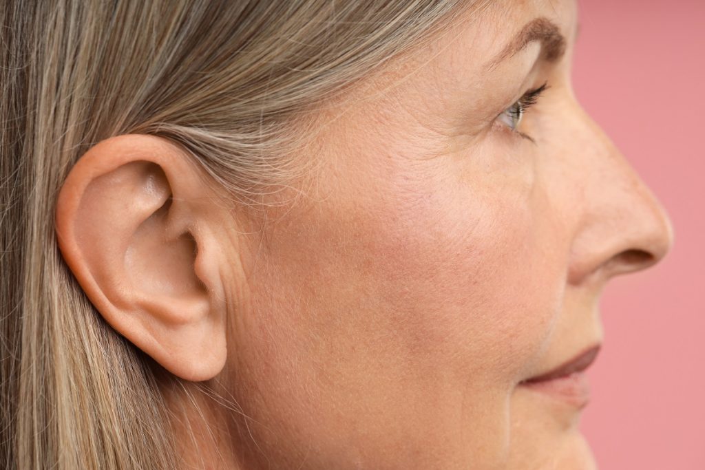 Minilifting facial en Madrid