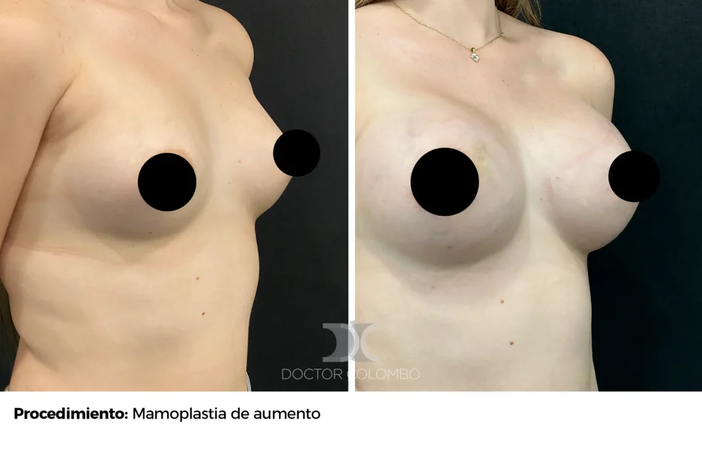 MPA — 1078 — Perfil derecho