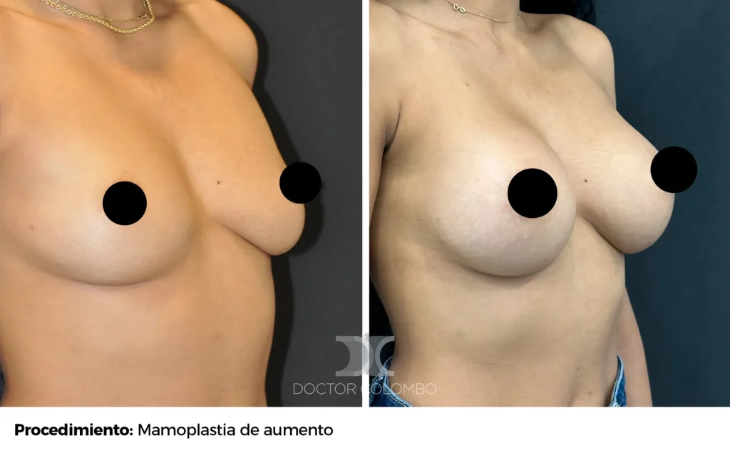 MPA — 1079 — Perfil derecho